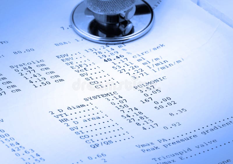 Echocardiographical test results with part of stethoscope, photo does not infringe any copyright. Echocardiographical test results with part of stethoscope, photo does not infringe any copyright