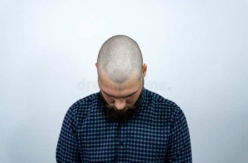 Foto de Renderização 3d De Uma Cabeça Masculina Sem Cabelo e mais fotos de  stock de Cabeça Humana - Cabeça Humana, Calvície, Careca - iStock