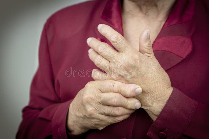 Reumatoïde Artritishanden