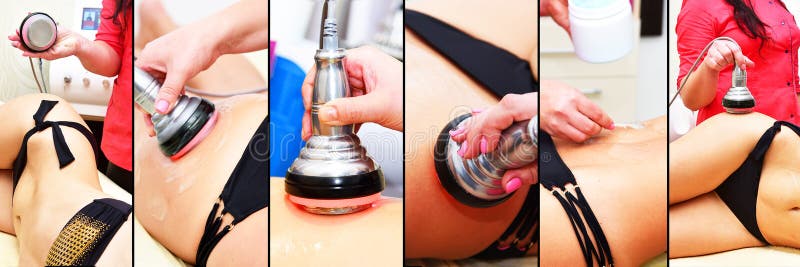 Rf skin tightening, belly. Hardware cosmetology. Body care. Non surgical body sculpting. Ultrasound cavitation body contouring tre royalty free stock images Rf skin tightening, belly. Hardware cosmetology. Body care. Non surgical body sculpting. Ultrasound cavitation body contouring tre royalty free stock images