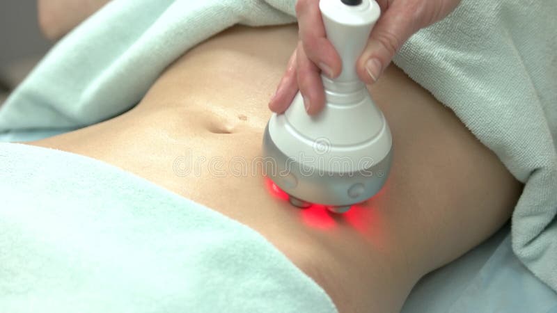 Rf skin tightening, female belly.