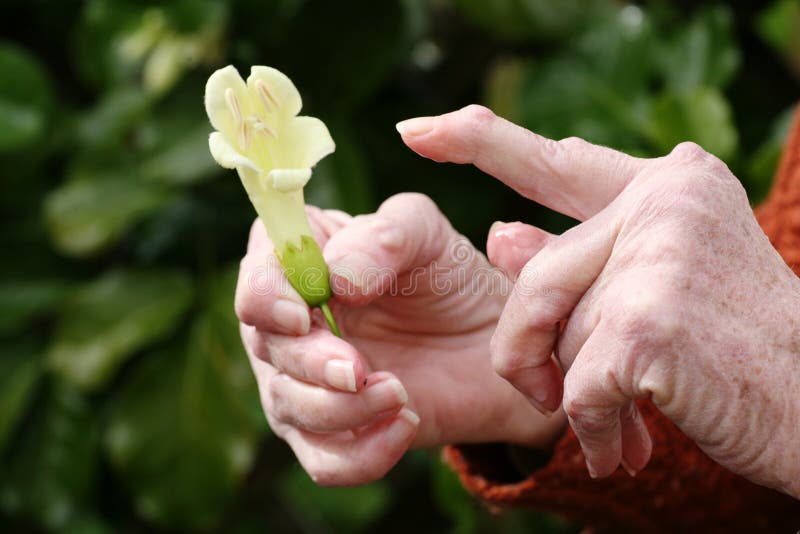 Rheumatoid Arthritis Hand And A Flower Royalty Free Stock Image Image