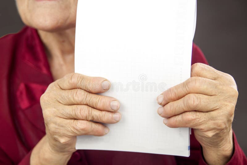 Rheumatoid arthritis hands royalty free stock image Rheumatoid arthritis hands royalty free stock image