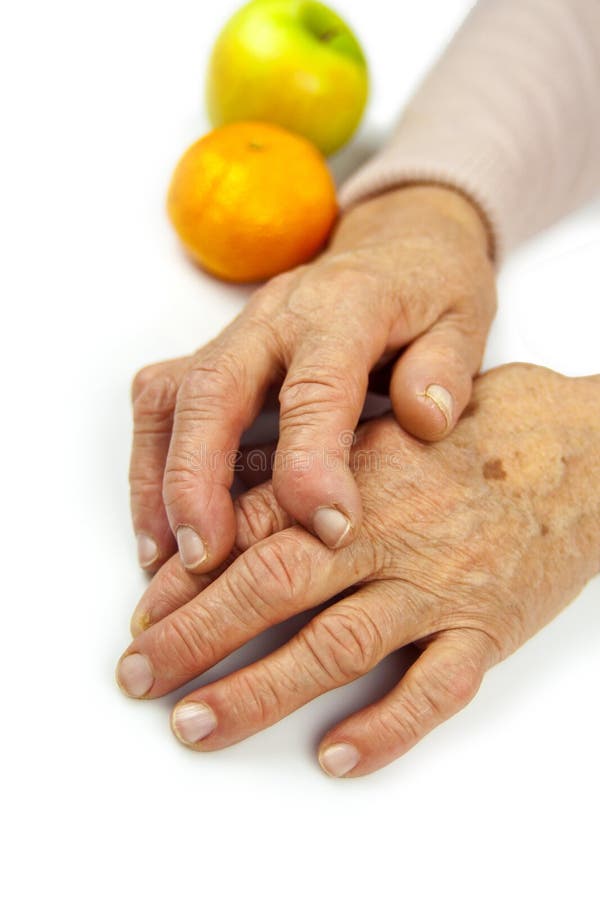 Rheumatoid Arthritis Hands And Fruits Stock Photo Image of shot