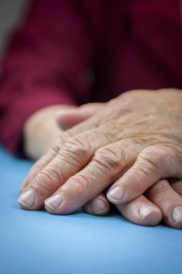 Rheumatoid arthritis hands royalty free stock images Rheumatoid arthritis hands royalty free stock images
