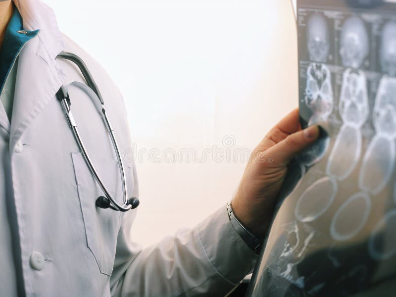 Ricerca di CT del cervello Immagine dei raggi X del cervello Medico, esaminante il radiogramma di una tomografia di computer su u immagine stock libera da diritti Ricerca di CT del cervello Immagine dei raggi X del cervello Medico, esaminante il radiogramma di una tomografia di computer su u immagine stock libera da diritti