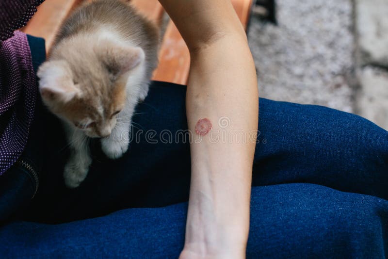 ringworm arm hand cat disease skin problem ringworm arm hand cat disease 190560793