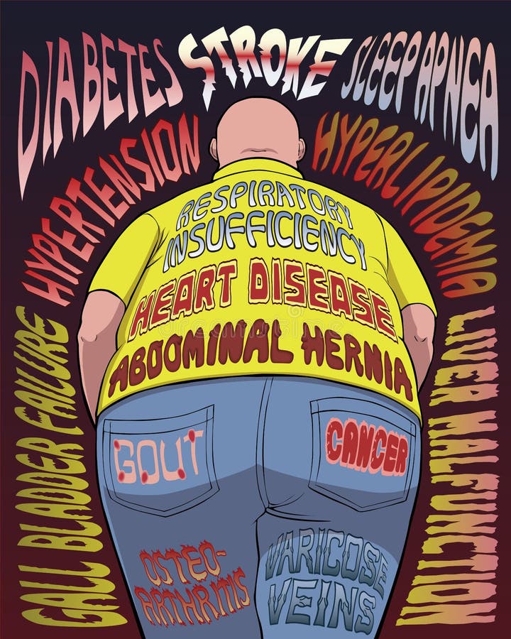 Poster with list of obesity-related diseases. Poster with list of obesity-related diseases