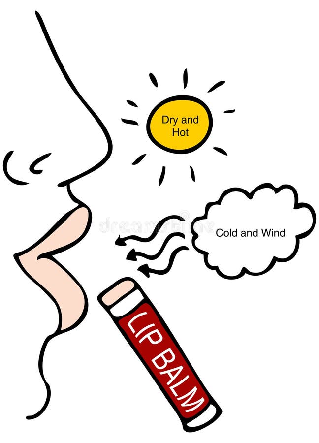 Rissige Lippen stock abbildung Rissige Lippen stock abbildung