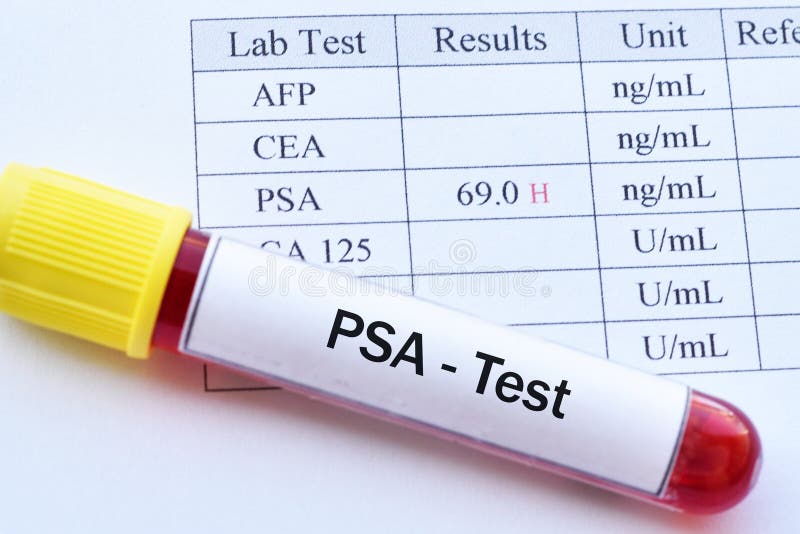 Risultato dei test elevato anormale di PSA immagini stock Risultato dei test elevato anormale di PSA immagini stock