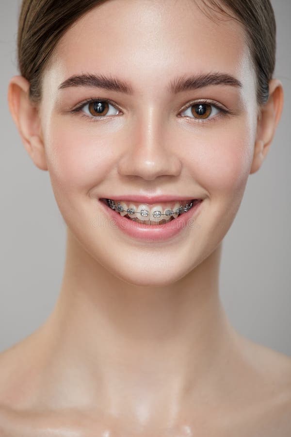 Ritratto di chiusura di una ragazza sorridente carina tra parentesi. fotografie stock