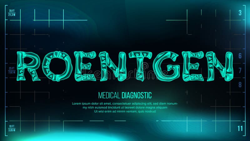 Rontgen vettore dell'insegna Priorità bassa medica Rontgen testo trasparente dei raggi x con le ossa Ricerca di radiologia 3D med illustrazione di stock Rontgen vettore dell'insegna Priorità bassa medica Rontgen testo trasparente dei raggi x con le ossa Ricerca di radiologia 3D med illustrazione di stock