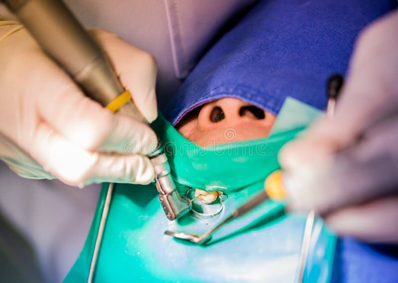 Root Canal or Endodontic Surgery and Surgical Equipments Stock Image