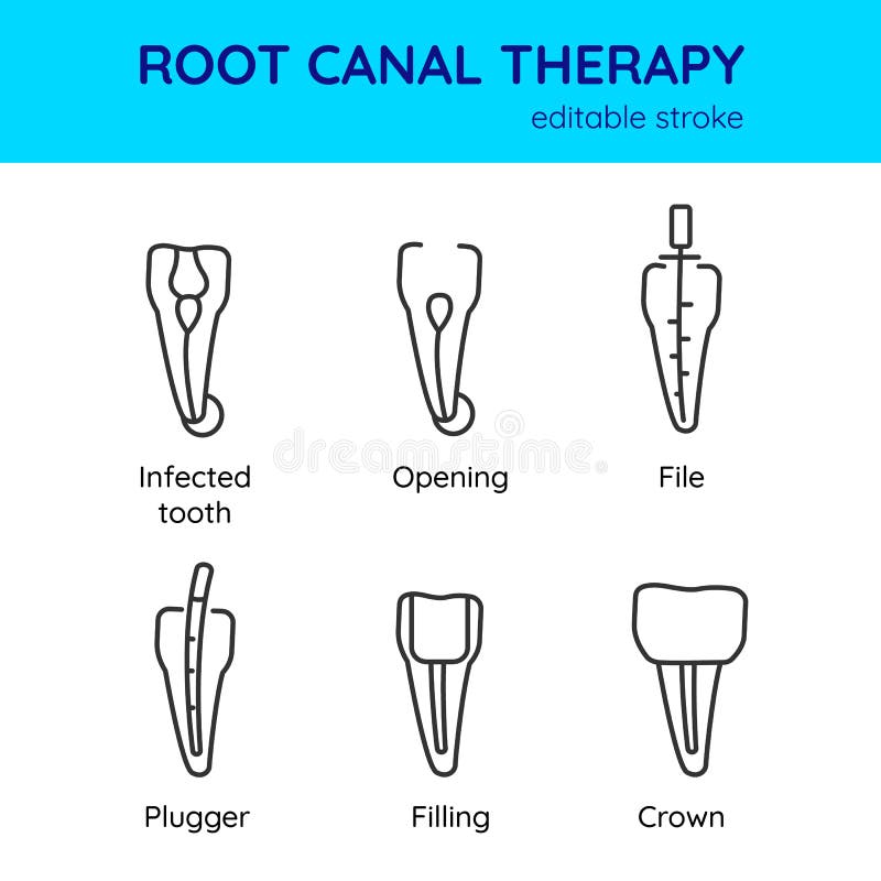 Root request. Эволюция удаления инструментов для зубов.