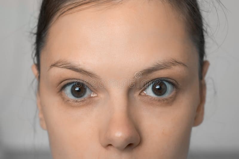 Rostro De Mujer Joven Sin Maquillaje Con Ojos De Primer Plano Nariz Y  Frente. Imagen de archivo - Imagen de morena, humano: 217704127