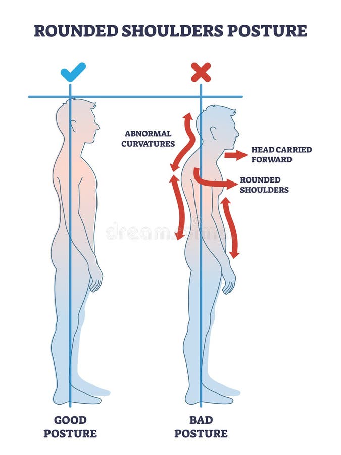 Rounded Shoulders Stock Illustrations – 49 Rounded Shoulders Stock  Illustrations, Vectors & Clipart - Dreamstime