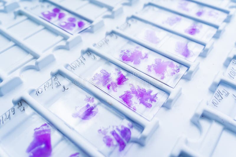 Rows of Microscope Glass Slide in the Cells Stock Photo Image of