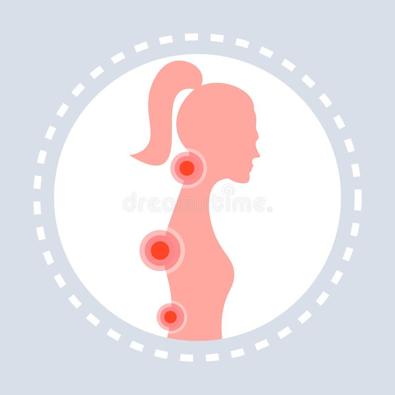 Rug en halsverwonding die het gezamenlijke van de de osteoporosescoliose van de pijnstekel van het ruggemergproblemen pijnlijke b vector illustratie Rug en halsverwonding die het gezamenlijke van de de osteoporosescoliose van de pijnstekel van het ruggemergproblemen pijnlijke b vector illustratie