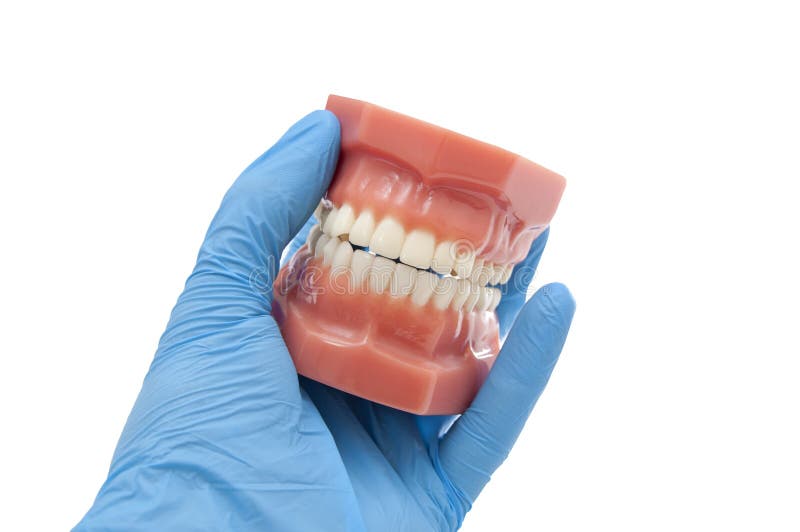 Résultats de traitement orthodontiques d'exposition de dentiste images stock Résultats de traitement orthodontiques d'exposition de dentiste images stock