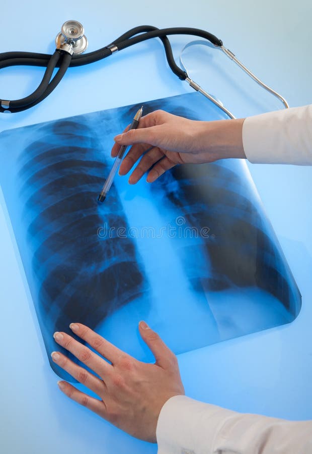 Röntgenstrahlbild der Lungen