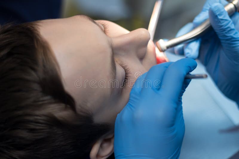 Ręki dentysta w błękitnych rękawiczkach z narzędzia zakończeniem Nastolatek przy doktorskim ` s spotkaniem taktuje zęby zdjęcie stock Ręki dentysta w błękitnych rękawiczkach z narzędzia zakończeniem Nastolatek przy doktorskim ` s spotkaniem taktuje zęby zdjęcie stock
