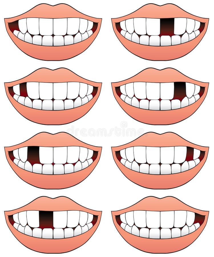 Jogo de correspondência com dentes e boca. atividade matemática de  atendimento odontológico para crianças em idade pré-escolar. planilha de  contagem de clínica dentista. enigma educacional com elementos engraçados  bonitos para crianças.