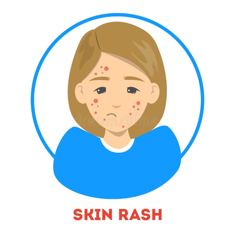 Sad woman suffering from a skin rash. Acne vector illustration