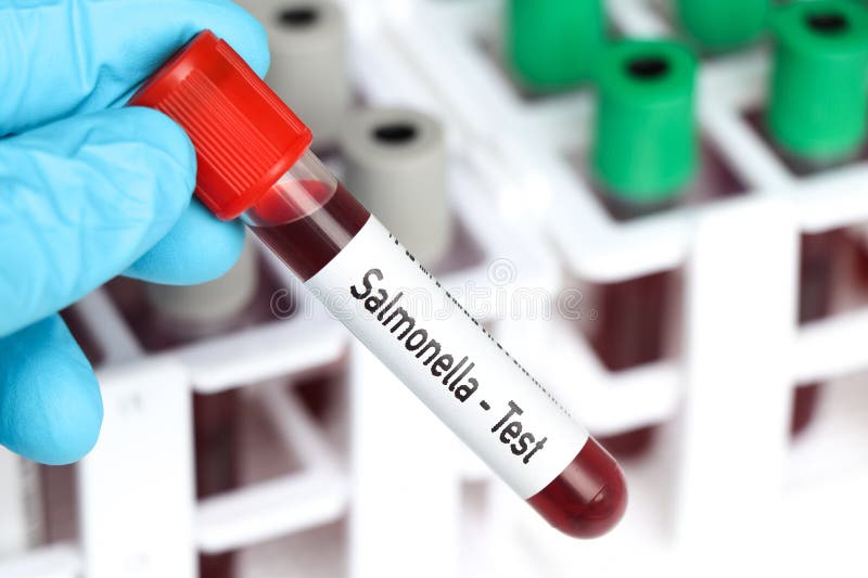 Salmonella Test, Blood Sample To Analyze in the Laboratory Stock Photo