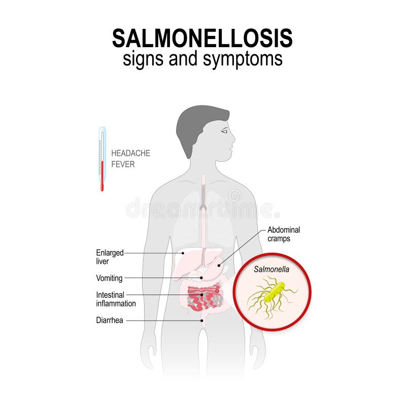 Salmonellainfectie Menselijke Darmen En Bacterie Die Deze Ziekte