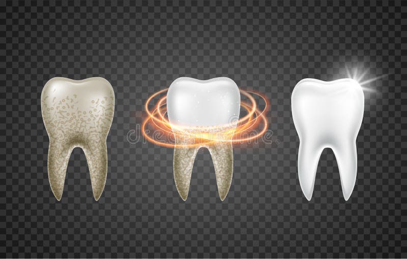 Salute pulita 3d del dente Imbiancatura sporca realistica dentaria Modello della medicina di igiene dei denti del dentista royalty illustrazione gratis Salute pulita 3d del dente Imbiancatura sporca realistica dentaria Modello della medicina di igiene dei denti del dentista royalty illustrazione gratis
