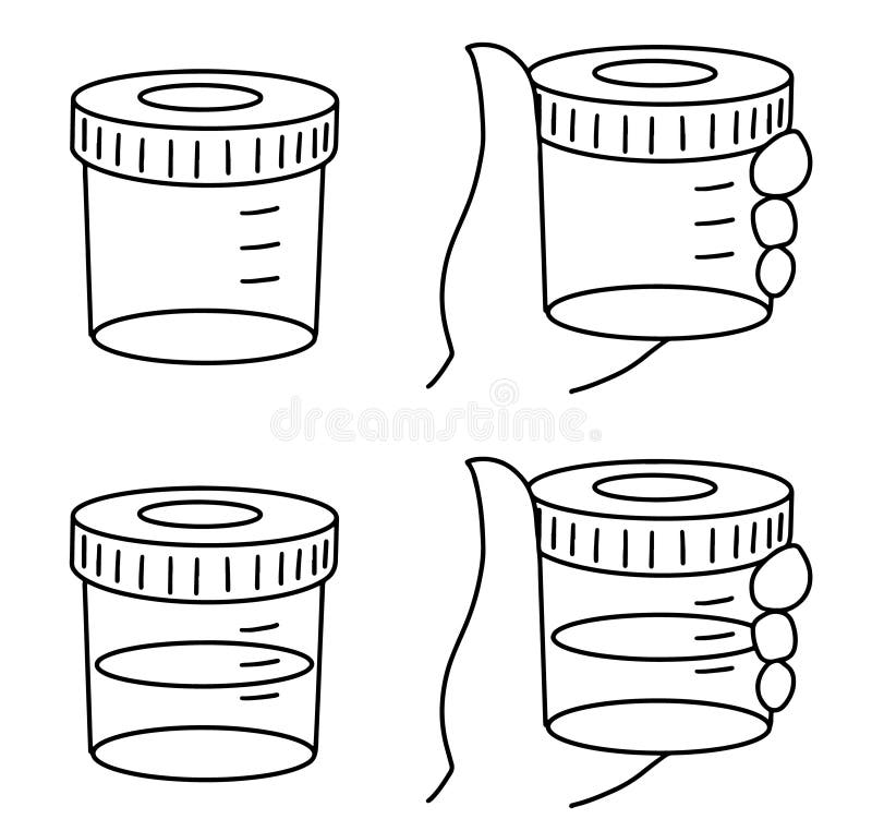 Sample Medical urinalysis laboratory test in hand royalty free illustration