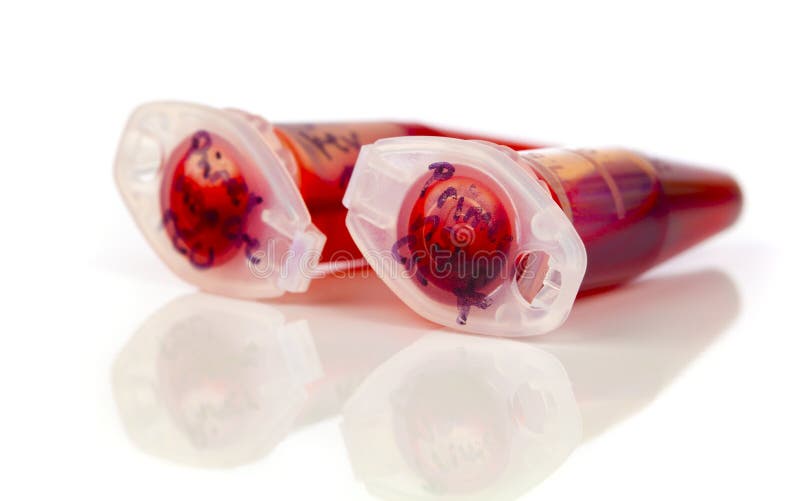 Sample of stem cells in the reaction tube stock photography Sample of stem cells in the reaction tube stock photography