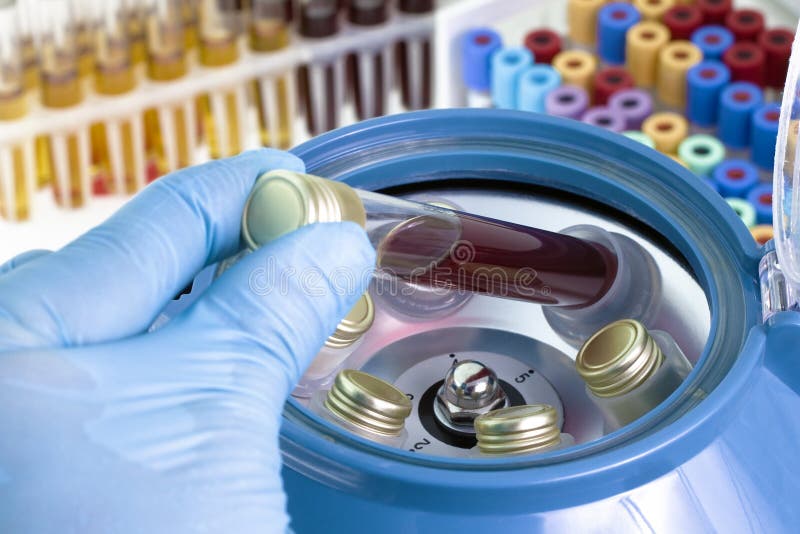 Sang de centrifugation image stock. Image du chemical - 44404339