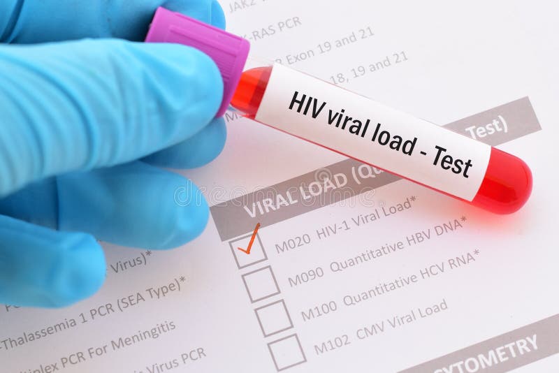 Sangue per il test di carico virale di HIV immagine stock Sangue per il test di carico virale di HIV immagine stock