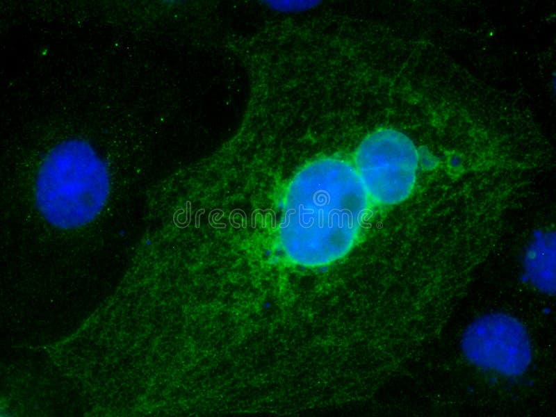 Sars-Cov-2 coronavirus infected Vero E6 cells reacting to antibody raised against nsp and structural proteins