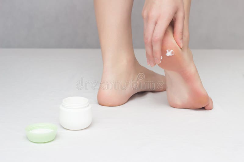 Sbavature della ragazza che guariscono crema sui suoi talloni contro le crepe e la pelle asciutta, fondo bianco, primo piano, der fotografie stock libere da diritti Sbavature della ragazza che guariscono crema sui suoi talloni contro le crepe e la pelle asciutta, fondo bianco, primo piano, der fotografie stock libere da diritti
