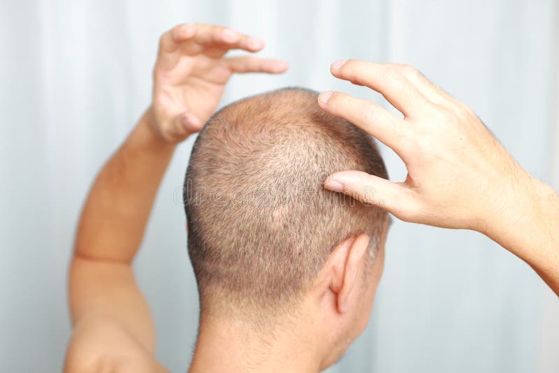 Scalp massage stock photo. Image of adult, stress, hair 43791730