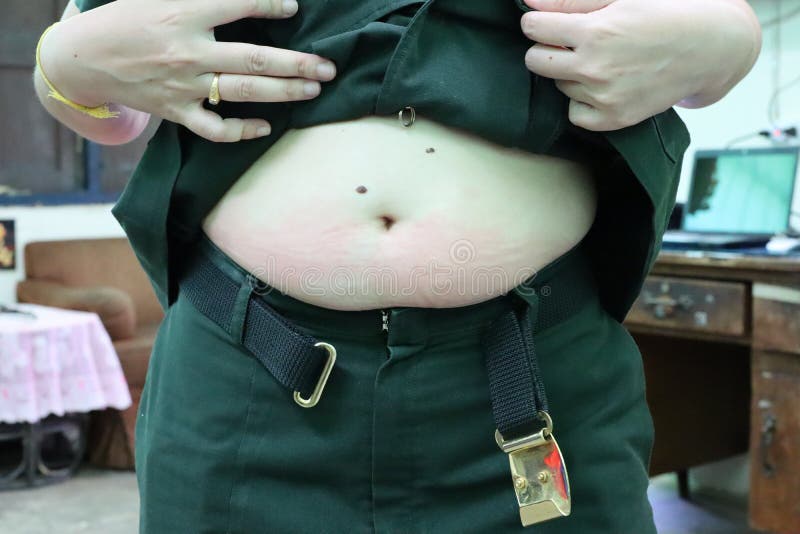 Schließen Sie herauf den Bauch, den ältere Asiatinnen mit schwarzen Molen auf der Haut beleibt sind, Magen, Bauch, großes Fett lizenzfreie stockfotos Schließen Sie herauf den Bauch, den ältere Asiatinnen mit schwarzen Molen auf der Haut beleibt sind, Magen, Bauch, großes Fett lizenzfreie stockfotos