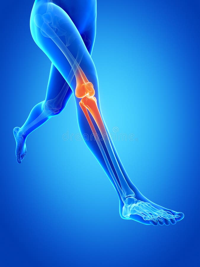 Schmerz Im Knie Stock Abbildung. Illustration Von Entflammt - 38958328