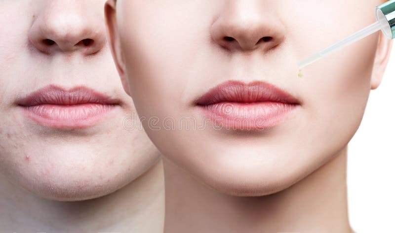 Schoonheidsmiddelenolie die op mollige vrouwelijke lippen van toepassing zijn stock foto Schoonheidsmiddelenolie die op mollige vrouwelijke lippen van toepassing zijn stock foto