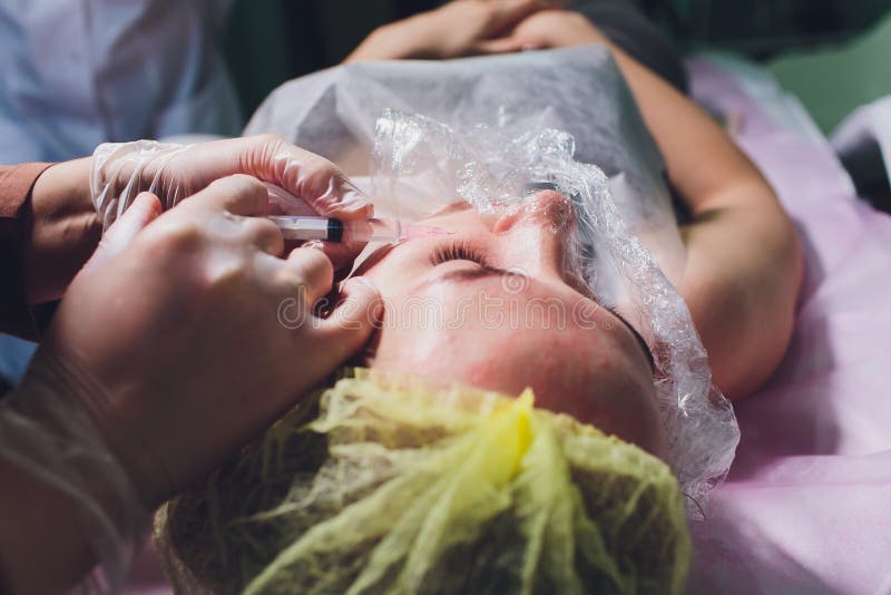 Schoonheidsspecialist die injectie in vrouwen` s gezicht maken, close-up Biorevitalizationprocedure stock foto Schoonheidsspecialist die injectie in vrouwen` s gezicht maken, close-up Biorevitalizationprocedure stock foto