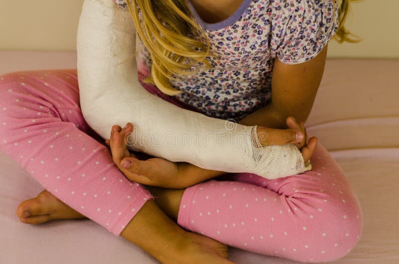 Schulter im Verband stockfoto. Bild von gyps, gebrochen 59707058