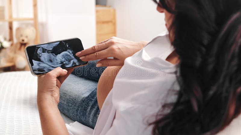 Schwangere brunette Frau mit bauchschauender Röntgenuntersuchung Diagnose auf Smartphone wartend Baby