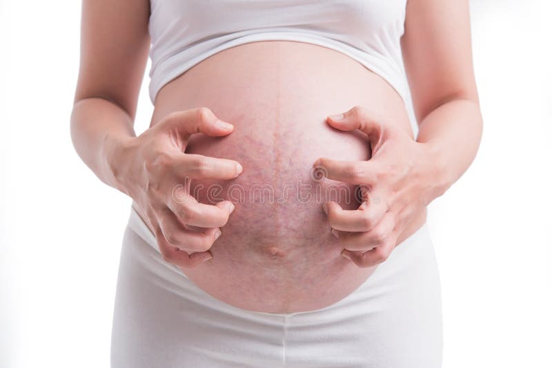 Schwangere Frauen, Dehnungsstreifen Weißhintergrund lizenzfreies stockbild Schwangere Frauen, Dehnungsstreifen Weißhintergrund lizenzfreies stockbild