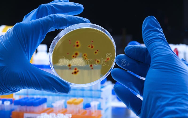 Scientist examines dengue virus on petri dish in laboratory royalty free stock images