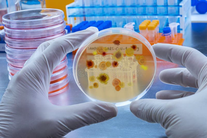 Scientist examines malaria virus on petri dish in laboratory royalty free stock images