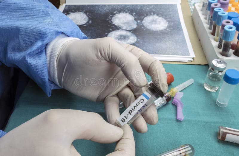 Scientist examines sample of coronavirus in laboratory stock image