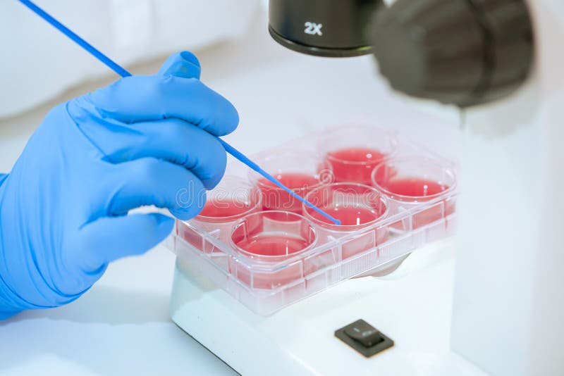 Scientist examines the sowing of pathogenic microflora in Petri dishes under a microscope stock image