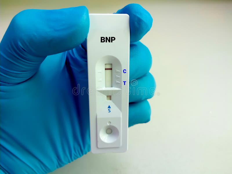 Scientist Hold a Test Device or Cassette for BNP Test. Rapid Screening