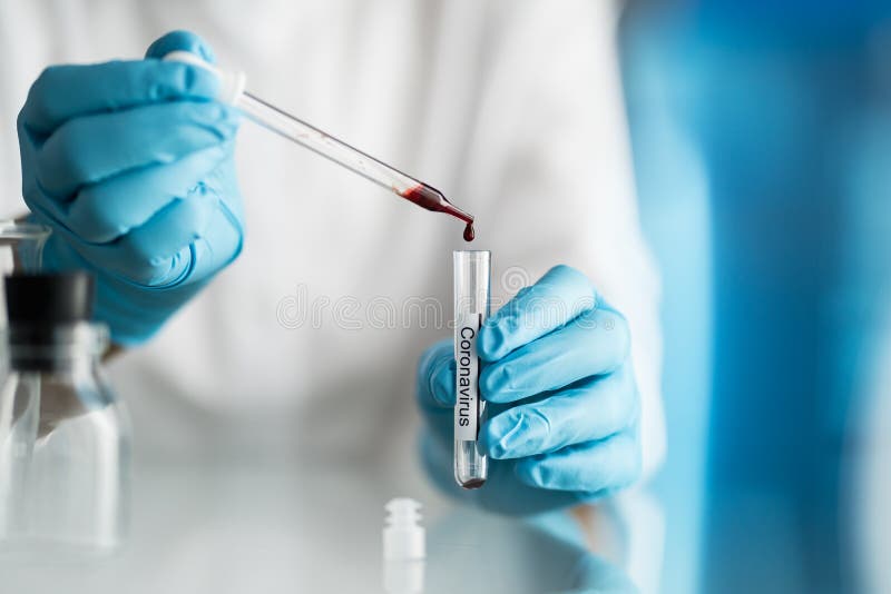 Scientist holding blood test tube with covid-19 or coronavirus label stock photography Scientist holding blood test tube with covid-19 or coronavirus label stock photography